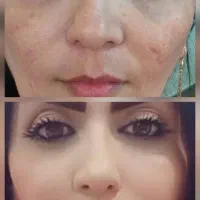 تخفیف 10 تا 20 درصدکلیه خدمات زیبایی در شمس ابادی|خدمات آرایشگری و زیبایی|اصفهان, خلجا|دیوار