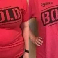 چربی سوزی شکم و پهلو