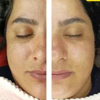 پاکسازی و فیشیال تخصصی