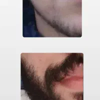 کمتر از یک ماه ریش دار شو