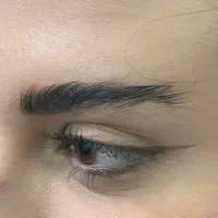 تخفیف ویژه بوتاکس فیلر و جوانسازی|خدمات آرایشگری و زیبایی|ورامین, خیر آباد|دیوار