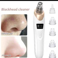 موزن و میکرودرم|آرایشی، بهداشتی، درمانی|قوچان, |دیوار