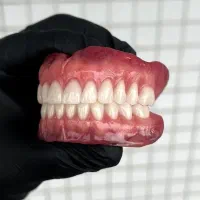 دندانسازی دندان مصنوعی و روکش، اقساطی از لابراتوار