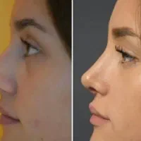 جشنواره جراحی زیبایی بینی ، پیکر تراشی و...|خدمات آرایشگری و زیبایی|تهران, جوادیه تهرانپارس|دیوار