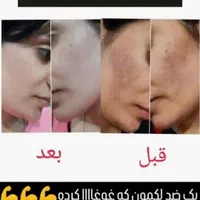 تنها دفترپخش درتهران کرم ضدلک لاکچری کوین((اصلی))|آرایشی، بهداشتی، درمانی|تهران, تجریش|دیوار