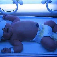 اجاره دستگاه اکسیژنساز و فتوتراپی زردی نوزاد