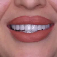 کامپوزیت ونیر|خدمات آرایشگری و زیبایی|قم, سالاریه|دیوار