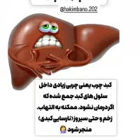 کبد چرب مرگ خاموش|خدمات آرایشگری و زیبایی|مینودشت, |دیوار