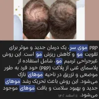 جشنواره خدمات ژل فقط 550و بوتاکس750|خدمات آرایشگری و زیبایی|فولادشهر, C3|دیوار