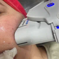 کرمپودر دائم و ژل و بوتاکس و هایفو|خدمات آرایشگری و زیبایی|اهواز, کیانپارس |دیوار