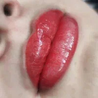 میکرو / شیدینگ / رفع تیرگی لب‌ %مدت محدود%