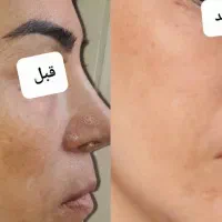 محصولات مراقبتی پوست ومو