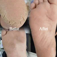 پدیکور و کف سابی پا