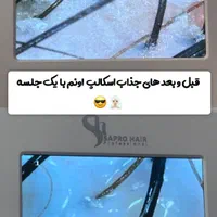 پاکسازی تخصصی کف سر + آنالیز رایگان +تخفیف بینظیر|خدمات آرایشگری و زیبایی|رودهن, |دیوار