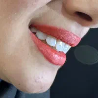 تخفیف ویژه ۲۰٪خدمات دندانپزشکی|خدمات آرایشگری و زیبایی|شیراز, ارم|دیوار