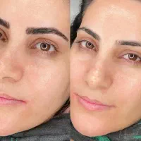 فیبروز میکرو بلیدینگ|خدمات آرایشگری و زیبایی|تهران, حکمت|دیوار