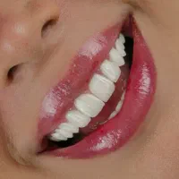 دندانپزشکی از دم قسط ایمپلنت عصبکشی روکش لمینت