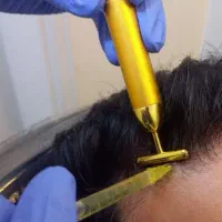 پی ارپی،مزوتراپی مو و صورت|خدمات آرایشگری و زیبایی|خرم‌آباد, |دیوار