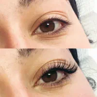 کاشت مژه مهریز