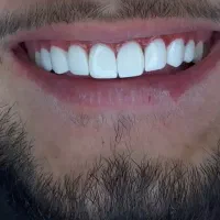 تخفیف ویژه کامپوزیت یلدایی|خدمات آرایشگری و زیبایی|شیراز, قصرالدشت|دیوار