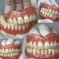دندانسازی ساخت دندان مصنوعی متحرک باضمانت|آرایشی، بهداشتی، درمانی|مشکیندشت, |دیوار