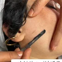 فیشیال و پاکسازی پوست|خدمات آرایشگری و زیبایی|پرند, فاز ۲|دیوار