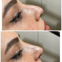 اصلاح فرم|خدمات آرایشگری و زیبایی|سنندج, |دیوار