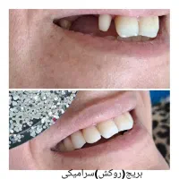 خدمات دندان پزشکی|خدمات آرایشگری و زیبایی|بروجرد, |دیوار