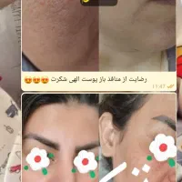 پکیچ لاغری چاقی پوست مو کبدچرب ناباروری...|خدمات آرایشگری و زیبایی|اهواز, زیباشهر|دیوار