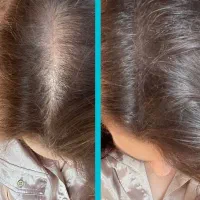 برای اولین بار در شمال کشور لاغری تضمینی|خدمات آرایشگری و زیبایی|چالوس, |دیوار