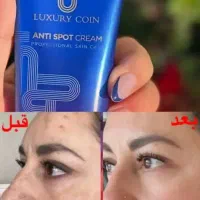 کرم ضد لک لاکچری کویین