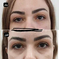 مرکزخدمات زیبایی درمانی دکتر سیدعلی پورحسینیGP|خدمات آرایشگری و زیبایی|رفسنجان, |دیوار