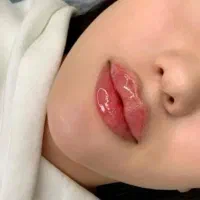 ژل بوتاکس فیلر نخ لیفت مزوتراپی کانتورینگ پی ارپی