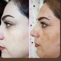 کرم چهل گیاه معجزه|آرایشی، بهداشتی، درمانی|شیراز, انجیر|دیوار