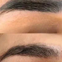 پاک کردن تتو های ابرو،خط لب ،خط چشم
