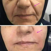 جوانسازی و شفافیت پوست