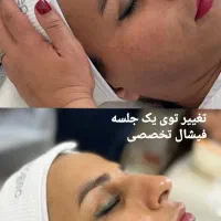 آموزش و خدمات  پاکسازی و فیشال  ویژه خانم و آقا