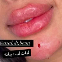 تخفیف ویژه ژل لب، فول فیس اموزش و تمام خدمات|خدمات آرایشگری و زیبایی|صدرا-فارس, فاز ۱|دیوار