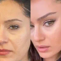 جراحی بینی لیفت بوتاکس نخ مزو فیلر فشیال|خدمات آرایشگری و زیبایی|شاهین‌شهر, عطار|دیوار
