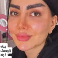 انجام خدمات ژل بوتاکس مزوتراپی