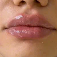 تخصصی فشیال با ضمانت