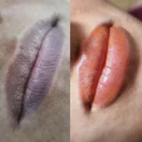 آموزش و رفع تیرگی لب(شیدینگ-تینت) تخصصی/ یک جلسه