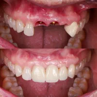 دندانپزشکی تخصصی ایمپلنت و ارتودنسی اقساطی