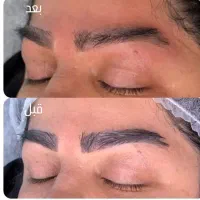 کلینیک پاک کردن تتو با لیزر آرامش