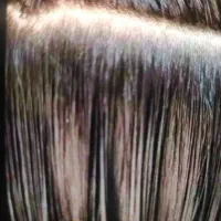 شـپـش    رشـک