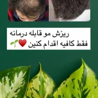 قطع ریزش مو و رویش مجدد مو و ریش