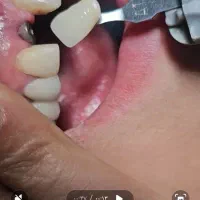 خانمی میانسال به بالا جهت پذیرایی از بیماران