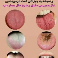 درمان باطب سنتی