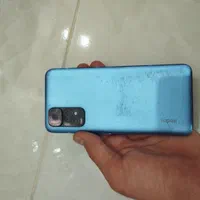 ردمی نوت 11s
