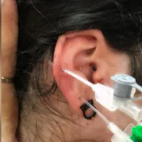 سوراخ کردن گوش و بینی